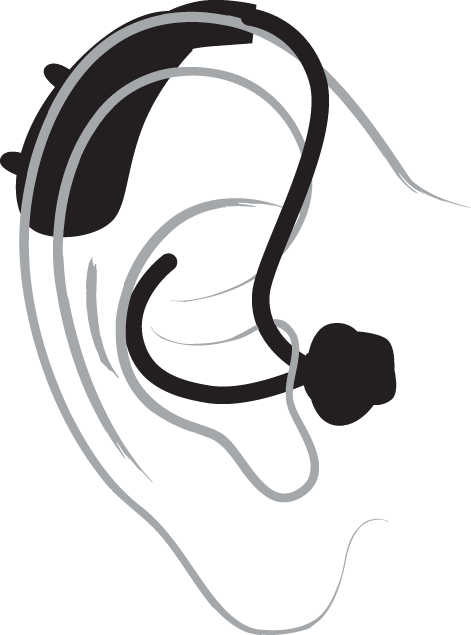 A technical drawing of a behind-the-ear hearing aid
